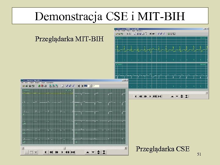 Demonstracja CSE i MIT-BIH Przeglądarka CSE 51 