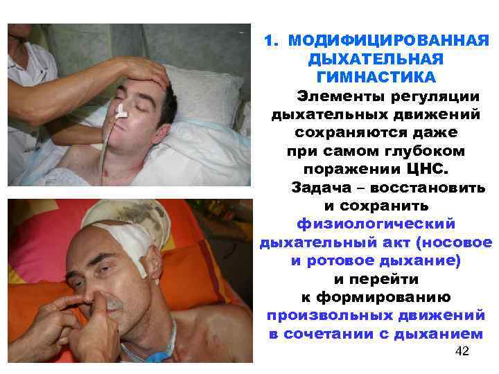 1. МОДИФИЦИРОВАННАЯ ДЫХАТЕЛЬНАЯ ГИМНАСТИКА Элементы регуляции дыхательных движений сохраняются даже при самом глубоком поражении