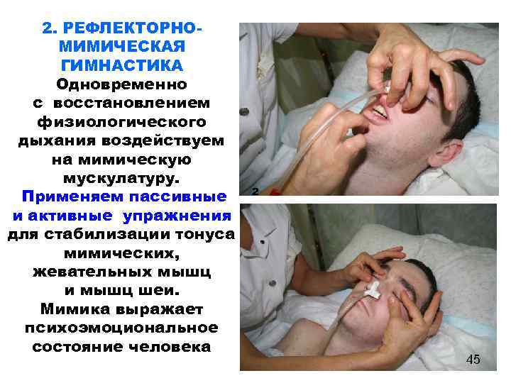 2. РЕФЛЕКТОРНОМИМИЧЕСКАЯ ГИМНАСТИКА Одновременно с восстановлением физиологического дыхания воздействуем на мимическую мускулатуру. Применяем пассивные