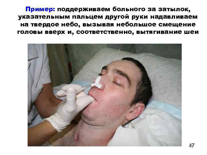 Пример: поддерживаем больного за затылок, указательным пальцем другой руки надавливаем на твердое небо, вызывая