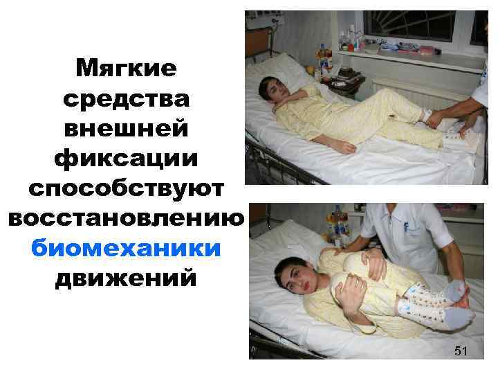 Мягкие средства внешней фиксации способствуют восстановлению биомеханики движений 51 