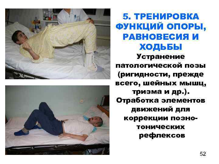 5. ТРЕНИРОВКА ФУНКЦИЙ ОПОРЫ, РАВНОВЕСИЯ И ХОДЬБЫ Устранение патологической позы (ригидности, прежде всего, шейных