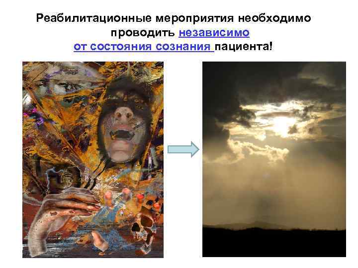 Реабилитационные мероприятия необходимо проводить независимо от состояния сознания пациента! 9 