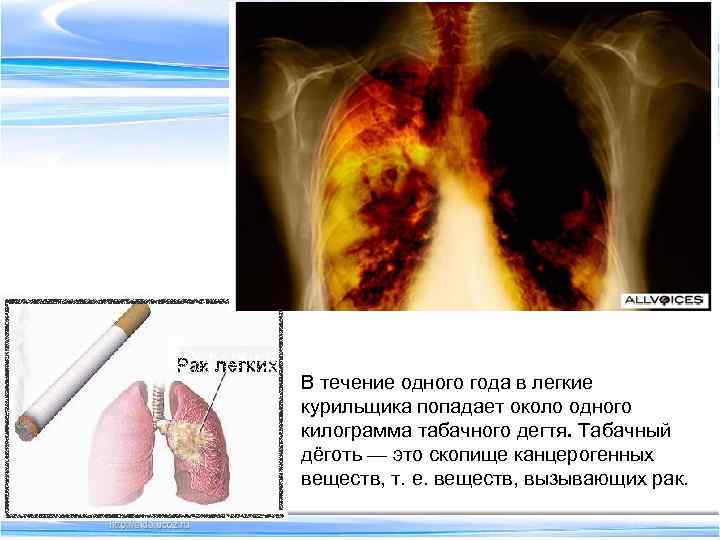 . В течение одного года в легкие курильщика попадает около одного килограмма табачного дегтя.