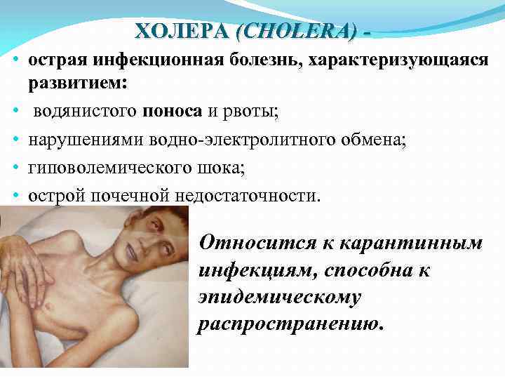 ХОЛЕРА (CHOLERA) • острая инфекционная болезнь, характеризующаяся развитием: • водянистого поноса и рвоты; •