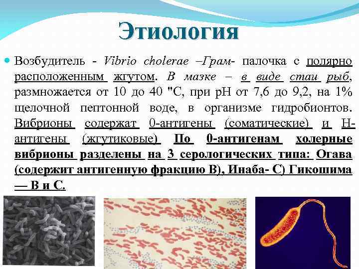 Этиология Возбудитель - Vibrio cholerae –Грам- палочка с полярно расположенным жгутом. В мазке –