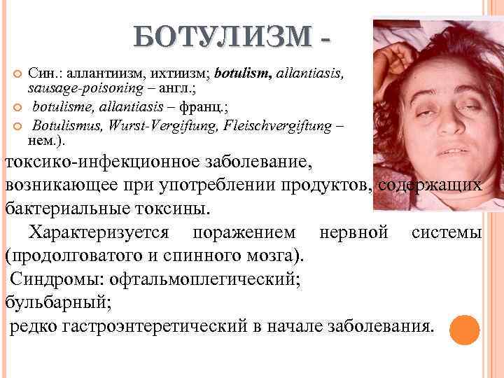 БОТУЛИЗМ Син. : аллантиизм, ихтиизм; botulism, allantiasis, sausage-poisoning – англ. ; botulisme, allantiasis –