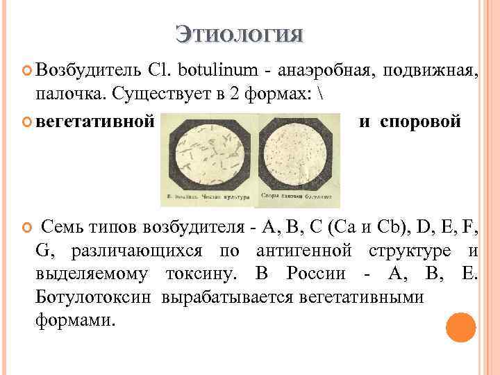 ЭТИОЛОГИЯ Возбудитель Cl. botulinum анаэробная, подвижная, палочка. Существует в 2 формах:  вегетативной и