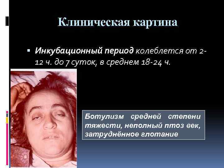 Клиническая картина Инкубационный период колеблется от 212 ч. до 7 суток, в среднем 18