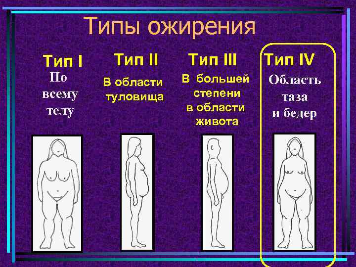 Типы ожирения Тип I По всему телу Тип III В области туловища В большей