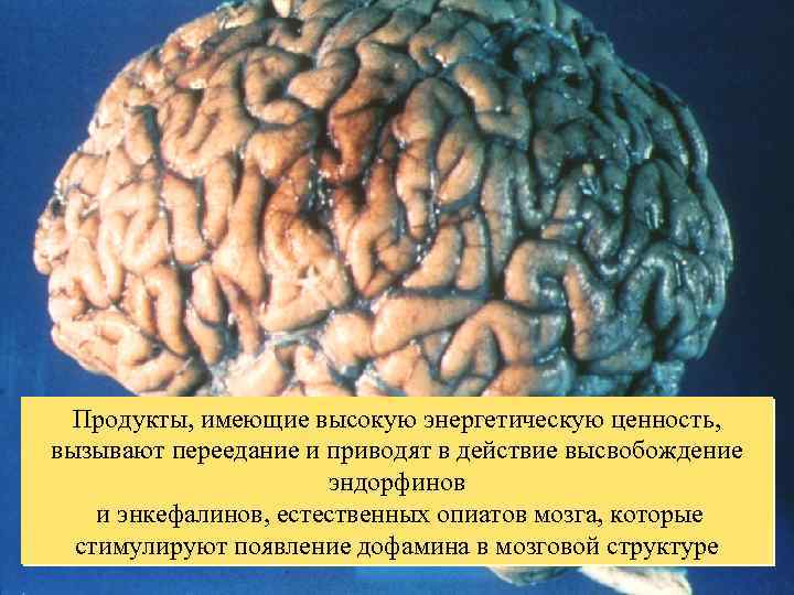 Продукты, имеющие высокую энергетическую ценность, вызывают переедание и приводят в действие высвобождение эндорфинов и