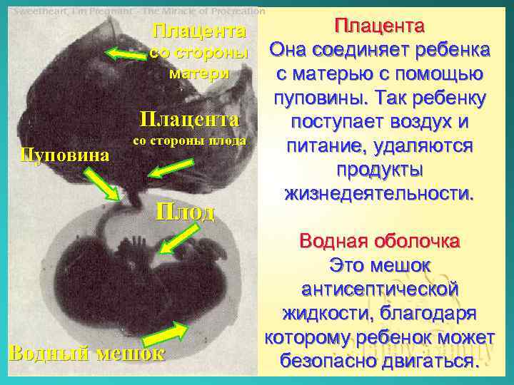 “Sweetheart, I’m Pregnant”- The Miracle of Procreation Плацента со стороны Она соединяет ребенка матери