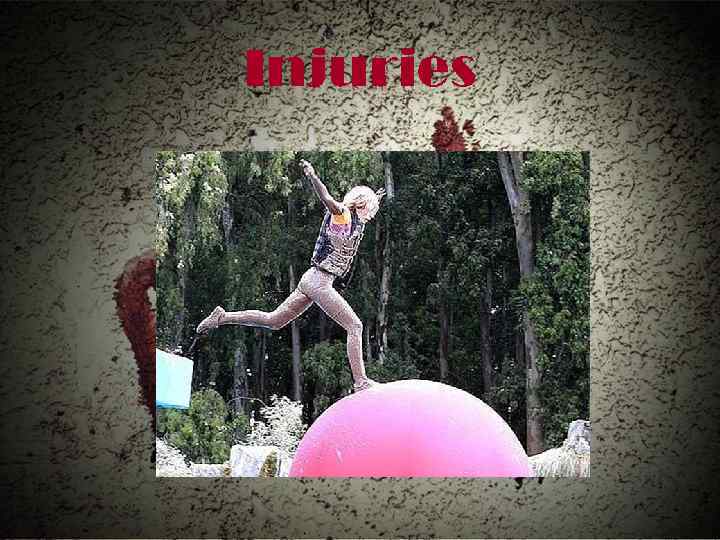 Injuries 