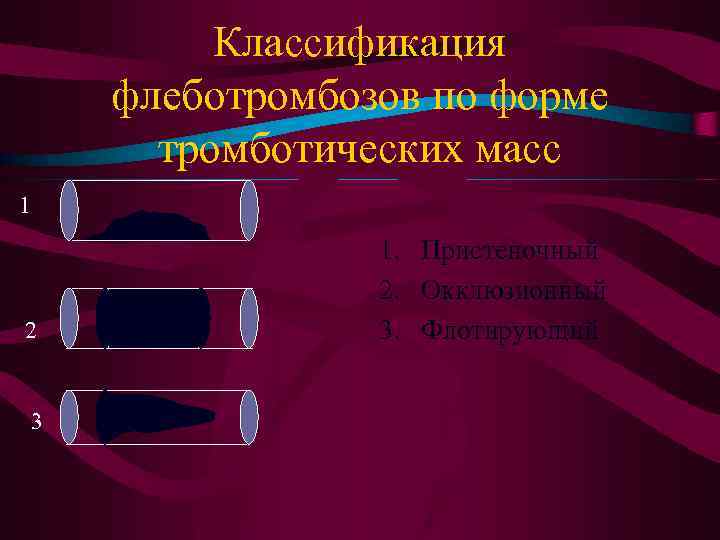 Классификация флеботромбозов по форме тромботических масс 1 2 3 1. Пристеночный 2. Окклюзионный 3.