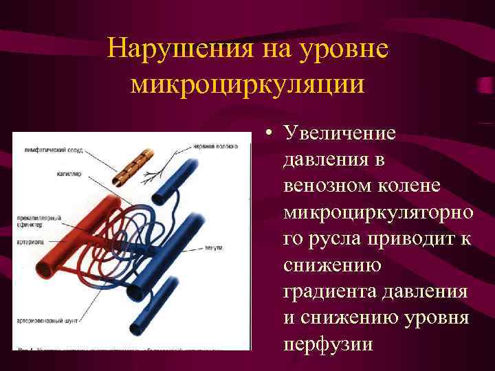 Нарушения на уровне микроциркуляции • Увеличение давления в венозном колене микроциркуляторно го русла приводит