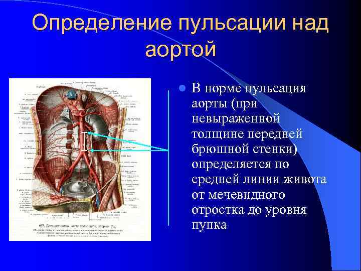 Основные характеристики артериального пульса схема