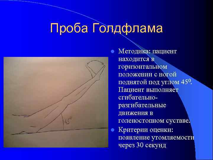 Проба Голдфлама Методика: пациент находится в горизонтальном положении с ногой поднятой под углом 450.