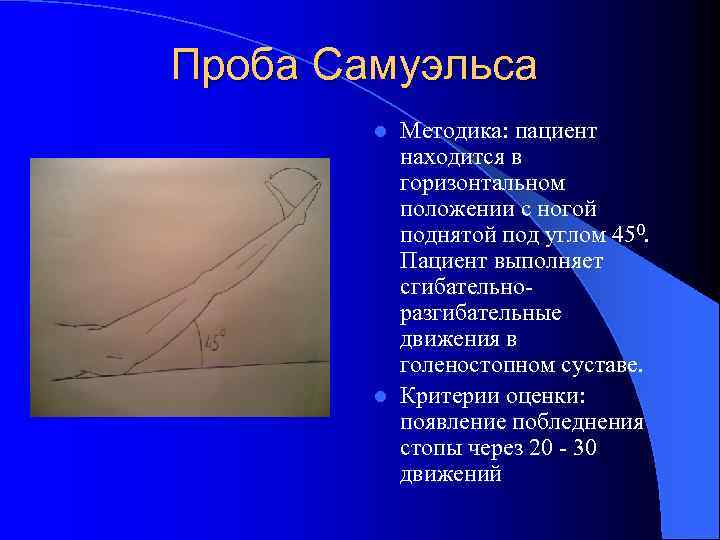 Проба Самуэльса Методика: пациент находится в горизонтальном положении с ногой поднятой под углом 450.