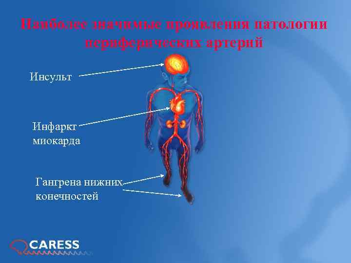 Периферические сосуды. Патологии периферических артерий.