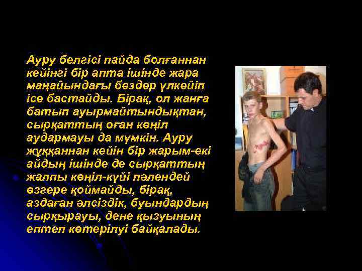  Ауру белгісі пайда болғаннан кейінгі бір апта ішінде жара маңайындағы бездер үлкейіп ісе