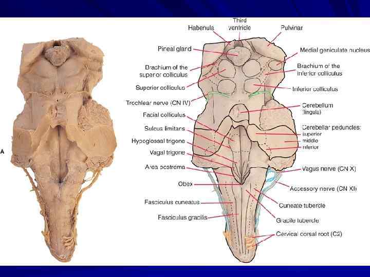 Продолговатый строение анатомия. Дорсальная поверхность ствола мозга. Вентральная и дорсальная поверхность продолговатого мозга. Продолговатый мозг анатомия препарат. Строение продолговатого мозга препарат.