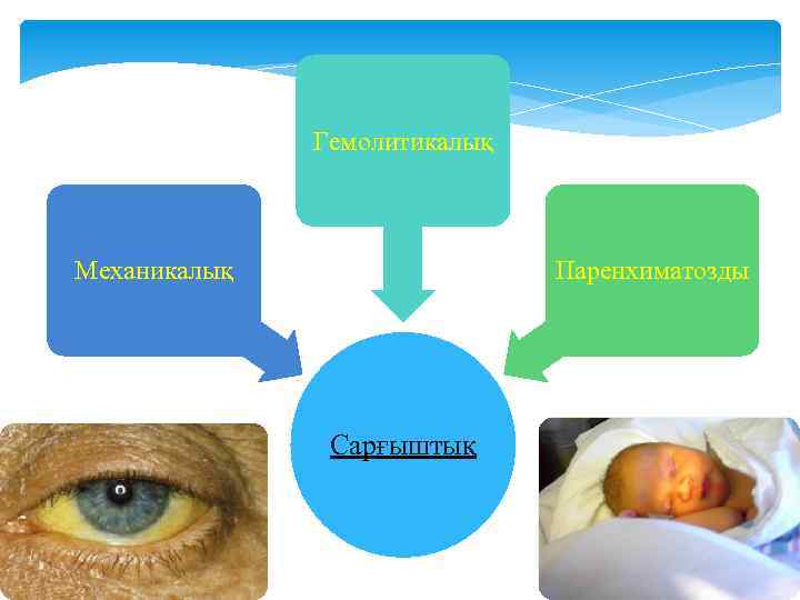 Гемолитикалық Механикалық Паренхиматозды Сарғыштық 