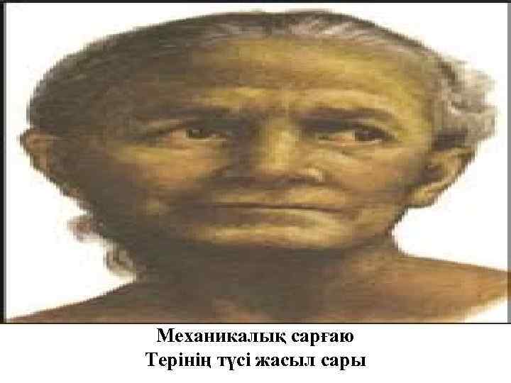 Механикалық сарғаю Терінің түсі жасыл сары 