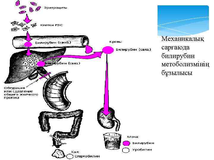 Механикалық сарғаюда билирубин метоболизмінің бұзылысы 
