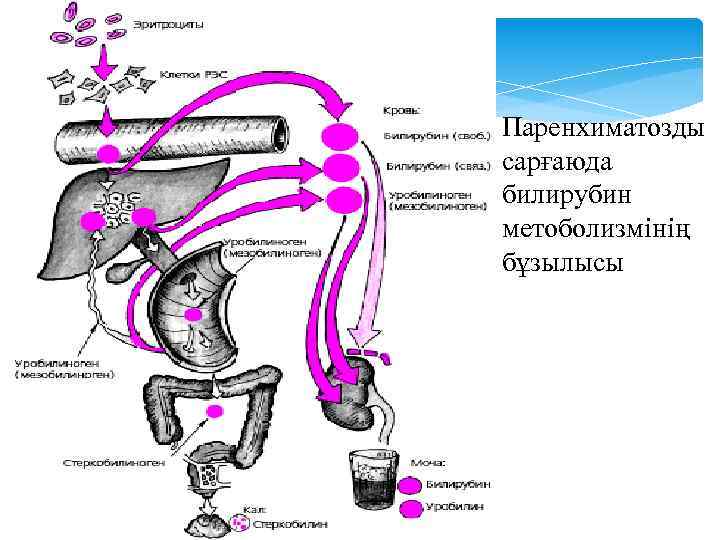 Паренхиматозды сарғаюда билирубин метоболизмінің бұзылысы 