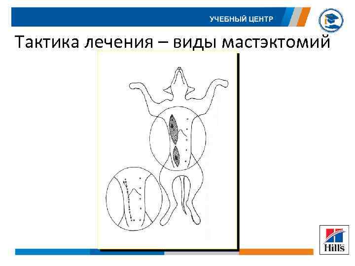 Тактика лечения – виды мастэктомий 