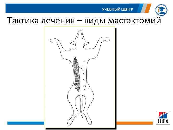 Тактика лечения – виды мастэктомий 