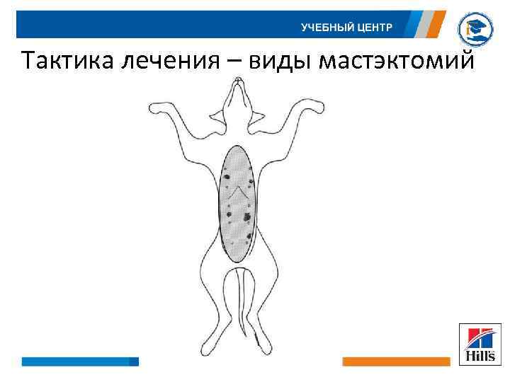 Тактика лечения – виды мастэктомий 