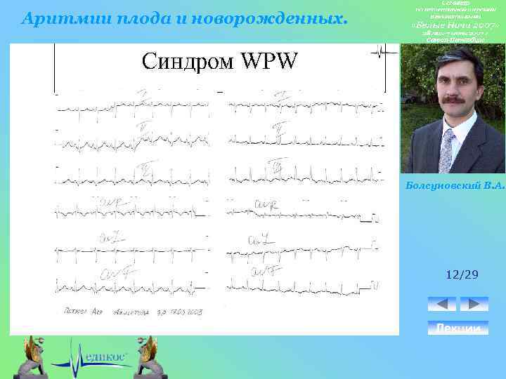 Аритмии плода и новорожденных. Болсуновский В. А. 12/29 Лекции 