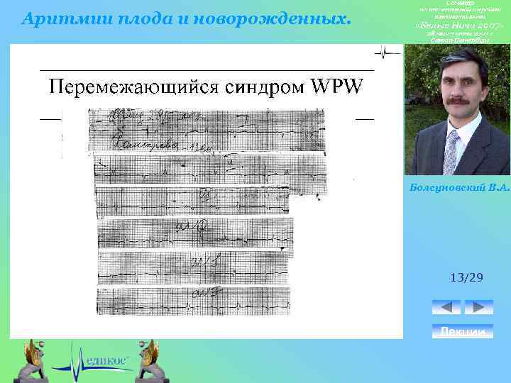 Аритмии плода и новорожденных. Болсуновский В. А. 13/29 Лекции 