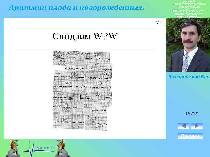 Аритмии плода и новорожденных. Болсуновский В. А. 15/29 Лекции 