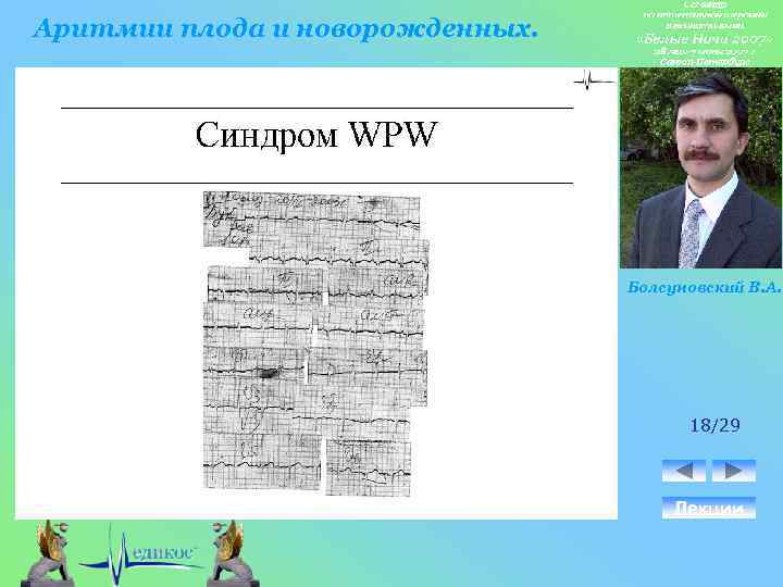 Аритмии плода и новорожденных. Болсуновский В. А. 18/29 Лекции 