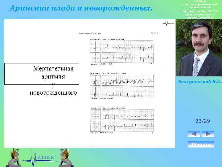 Аритмии плода и новорожденных. Болсуновский В. А. 23/29 Лекции 