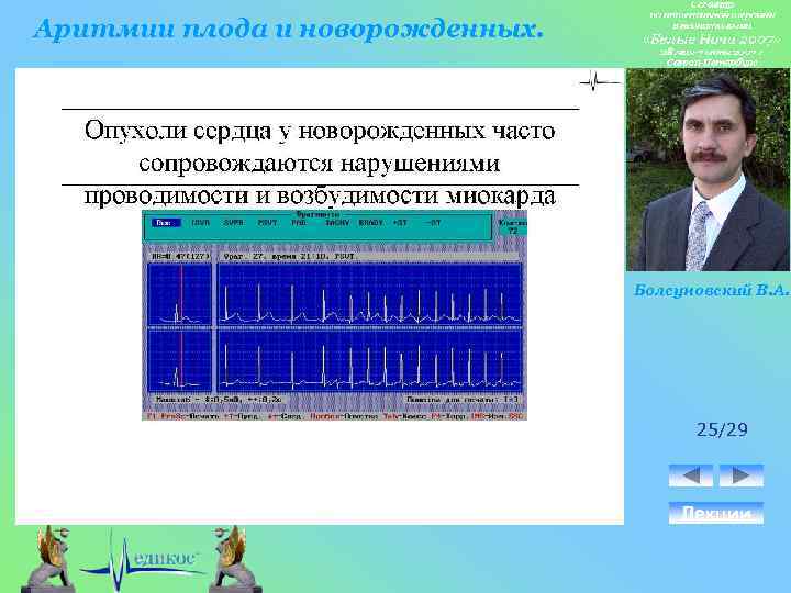 Аритмии плода и новорожденных. Болсуновский В. А. 25/29 Лекции 