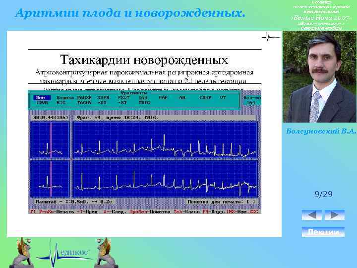 Аритмии плода и новорожденных. Болсуновский В. А. 9/29 Лекции 