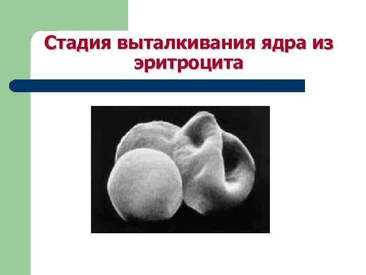 Стадия выталкивания ядра из эритроцита 