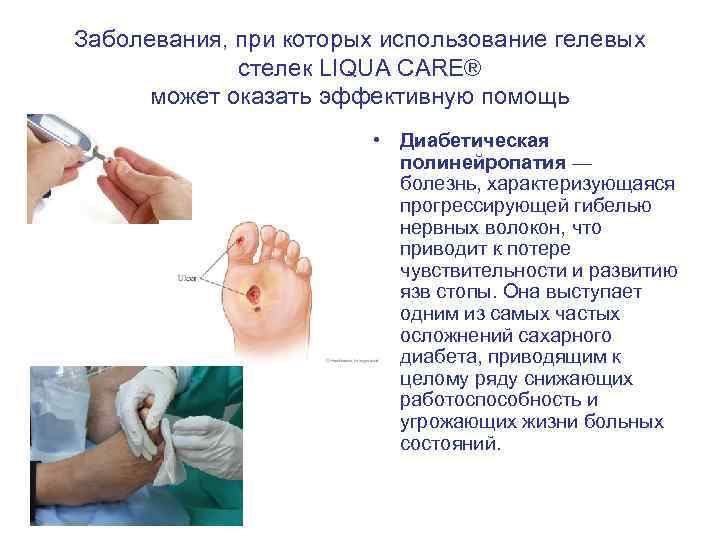 Заболевания, при которых использование гелевых стелек LIQUA CARE® может оказать эффективную помощь • Диабетическая