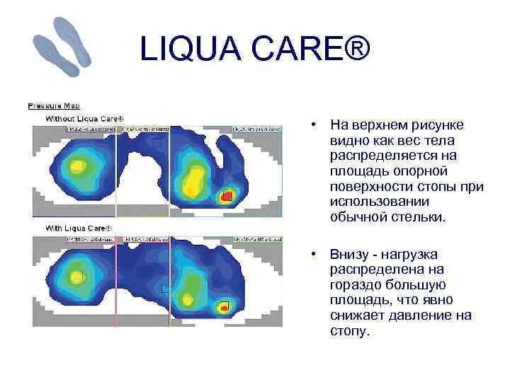 LIQUA CARE® • На верхнем рисунке видно как вес тела распределяется на площадь опорной