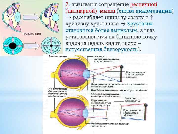 2. вызывают сокращение ресничной (цилиарной) мышц (спазм аккомодации) → расслабляет циннову связку и ↑