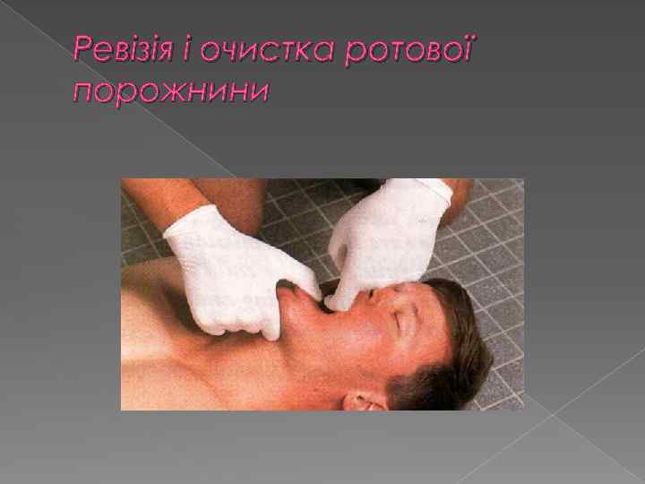 Ревізія і очистка ротової порожнини 