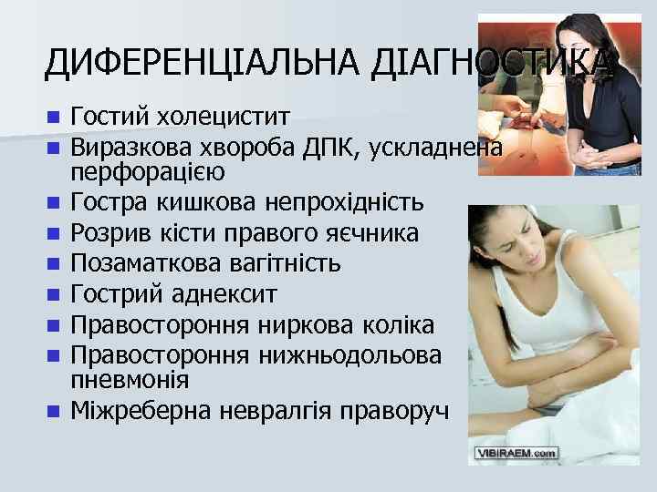 ДИФЕРЕНЦІАЛЬНА ДІАГНОСТИКА n n n n n Гостий холецистит Виразкова хвороба ДПК, ускладнена перфорацією