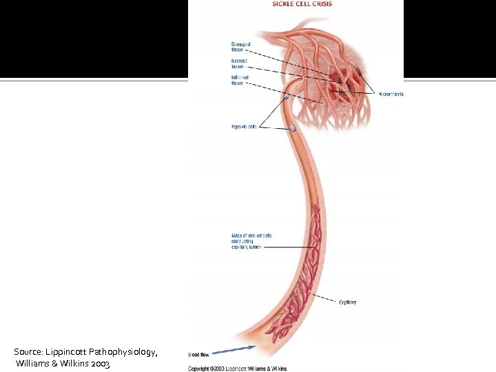 Source: Lippincott Pathophysiology, Williams & Wilkins 2003 