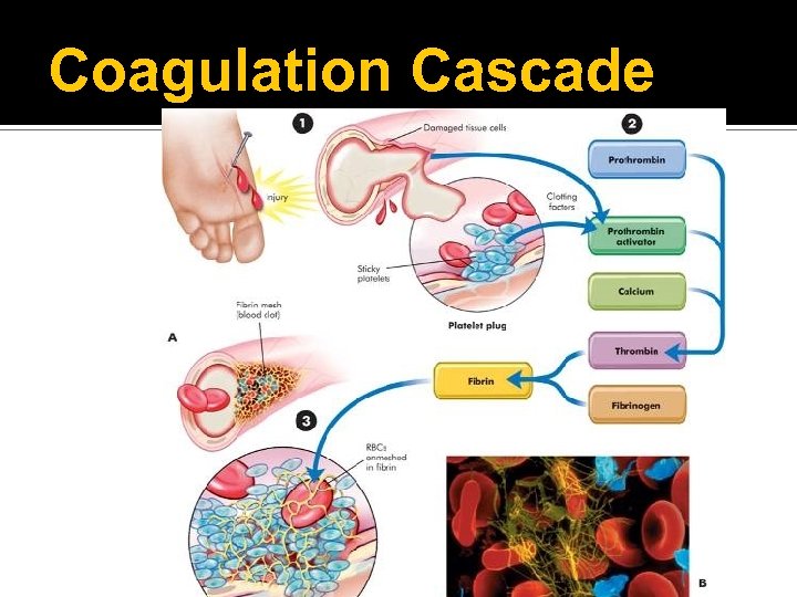 Coagulation Cascade 