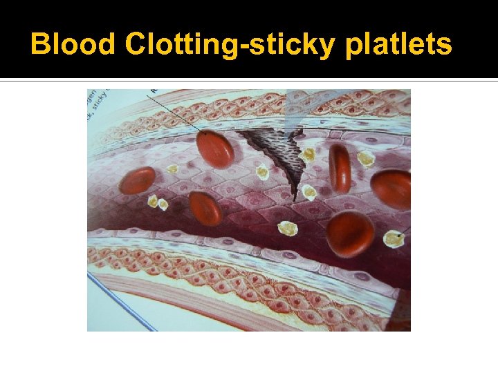 Blood Clotting-sticky platlets 