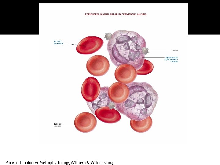 Source: Lippincott Pathophysiology, Williams & Wilkins 2003 