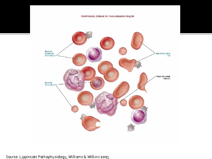 Source: Lippincott Pathophysiology, Williams & Wilkins 2003 